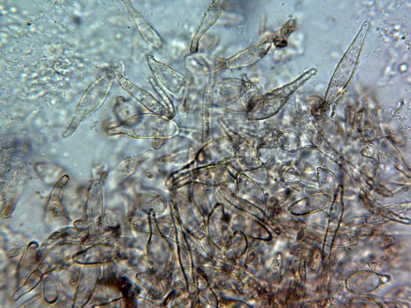 Boletus pinophilus 13 - Suprapellis agua x 400 2